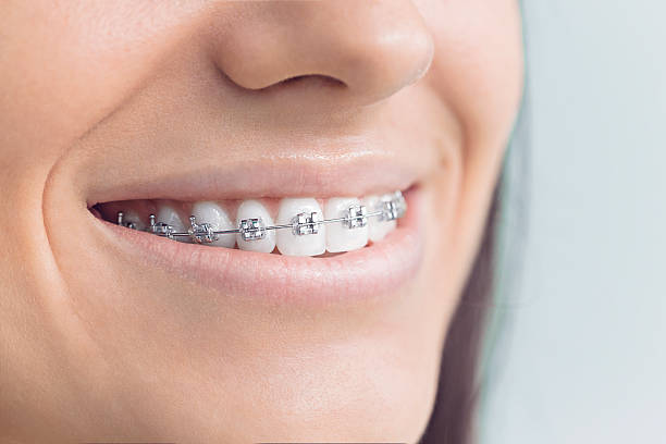 Best Crowns and Bridges  in Creve Coeur, IL